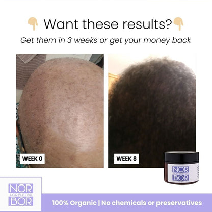 NORBOR BEAUTY - Organic Hair Growth Butter